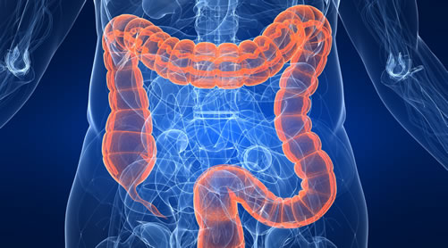 colon cancer screening graphic